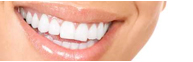 Veneers: aesthetic and kind to teeth